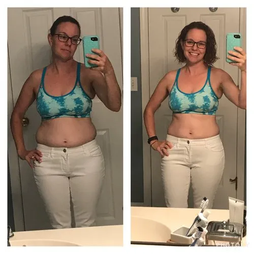 Before and after weight loss program - Patient 2