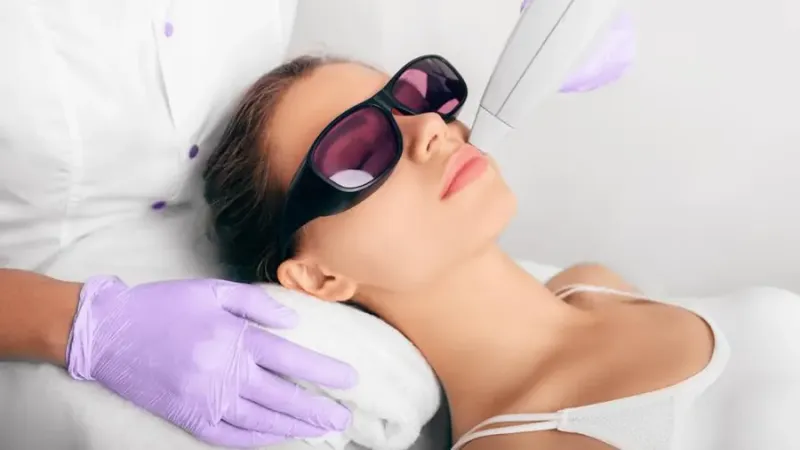 Laser hair removal treatment